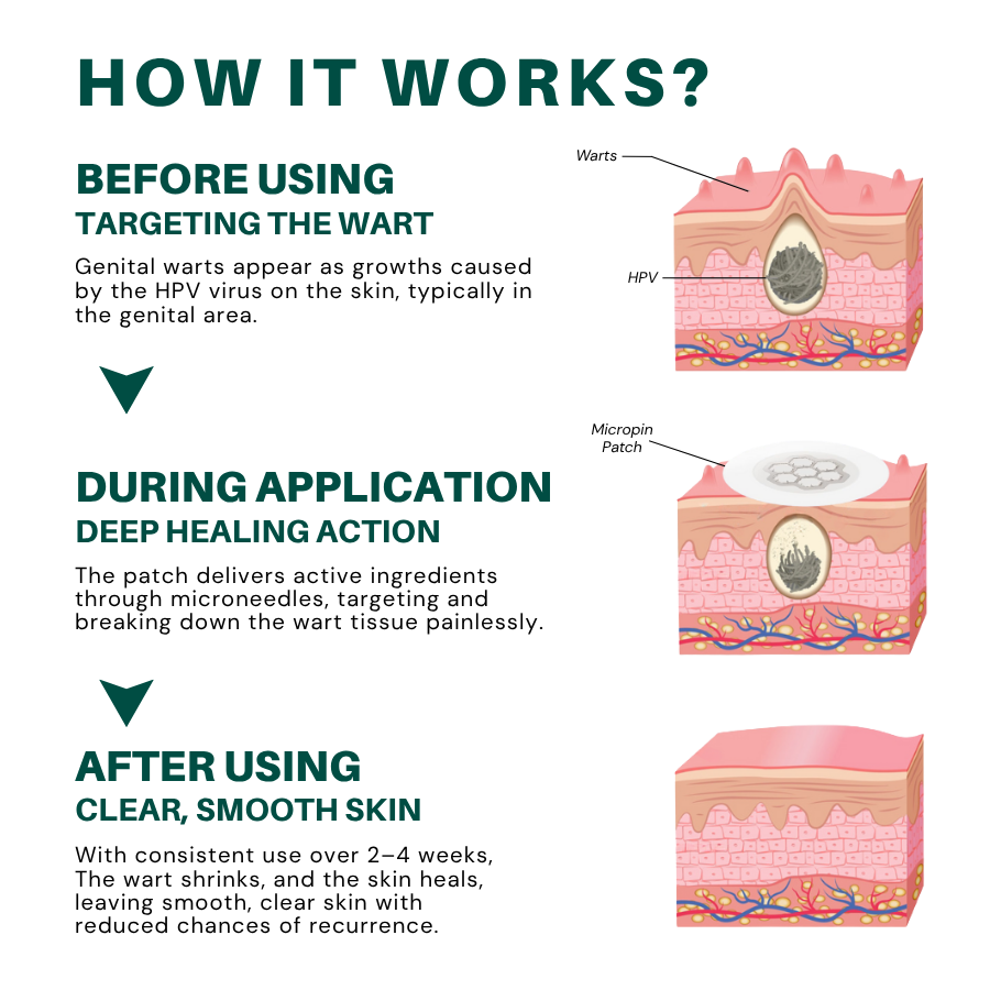 DermaSolve Targeted Warts Patches