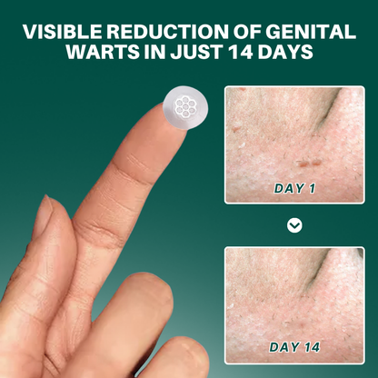 DermaSolve Targeted Warts Patches