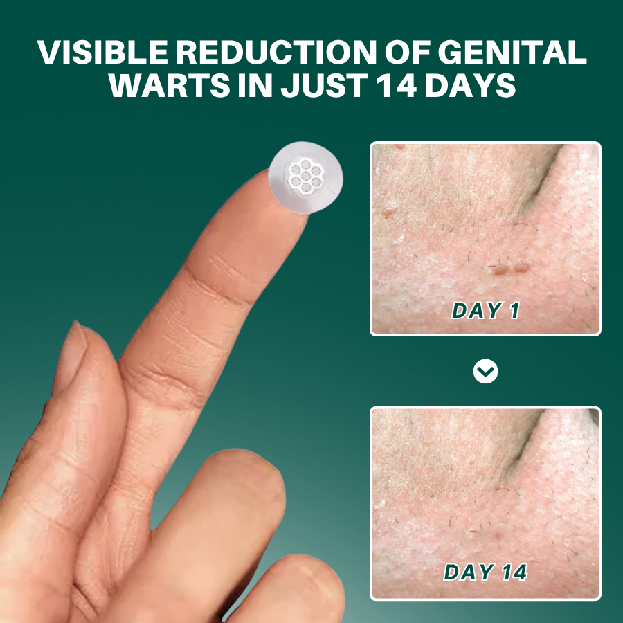 DermaSolve Targeted Warts Patches