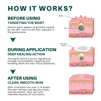DermaSolve Targeted Warts Patches